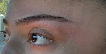 Close-up of a person's eyes looking to the side with natural skin texture visible.