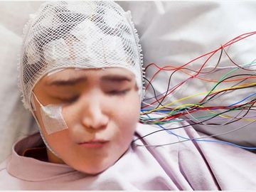Neurology, Long Term EEG