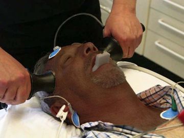 Electroconvulsive Therapy, ECT