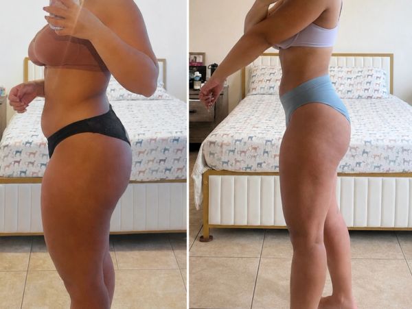 Before-and-after photos of a female patient showing her progress during a medically supervised weigh