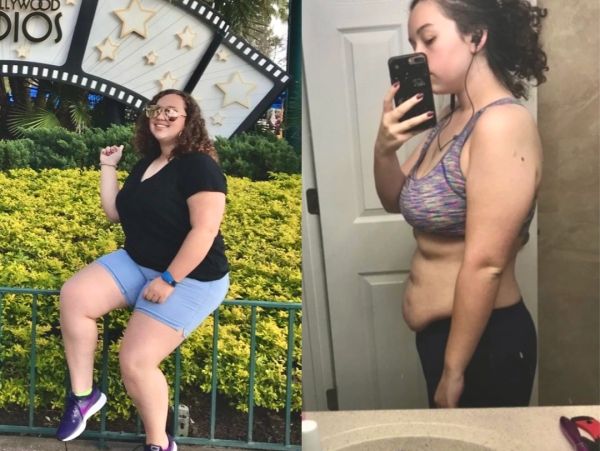 Before-and-after photos of a female patient showing her progress during a medically supervised weigh