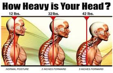 Chiropractor Allentown PA, poor posture, text neck, rolled shoulders, headaches, forward head