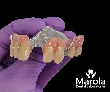 Cobalt Chrome denture