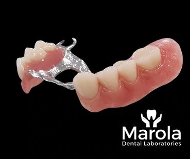 Chrome denture with gum characterisation