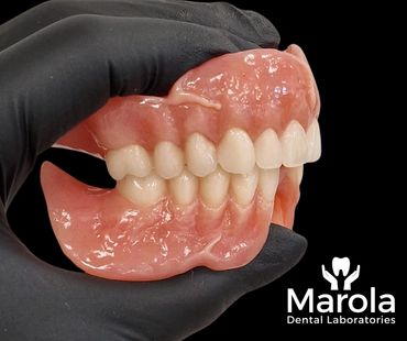 Acrylic denture made at Marola Dental prosthetic laboratory in Berkshire