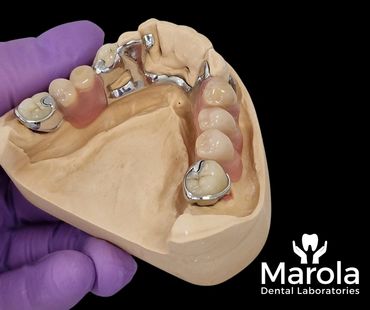 Acrylic/chrome denture made at Marola Dental prosthetic laboratory in Berkshire