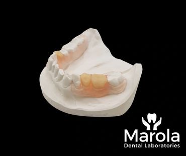 Valplast flexible denture made at Marola Dental prosthetic laboratory in Berkshire