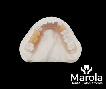 Valplast flexible denture made at Marola Dental prosthetic laboratory in Berkshire