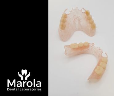 Valplast flexible denture made at Marola Dental prosthetic laboratory in Berkshire