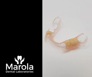 Valplast flexible denture made at Marola Dental prosthetic laboratory in Berkshire
