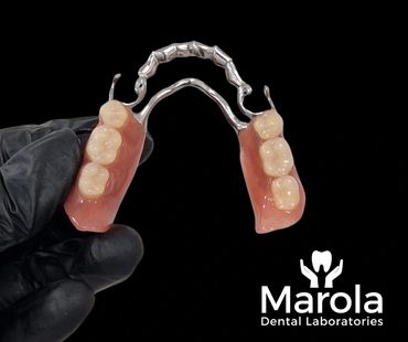 Cobalt chrome denture