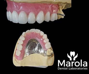 Acrylic/chrome denture made at Marola Dental prosthetic laboratory in Berkshire