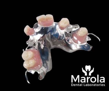 Acrylic/chrome denture made at Marola Dental prosthetic laboratory in Berkshire