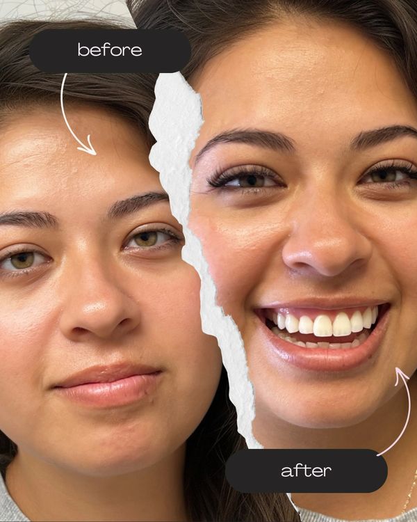 eyelash extensions, natural lash extensions, UV light, lash extensions, classic lash extensions