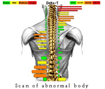 Infrared Thermography Scan