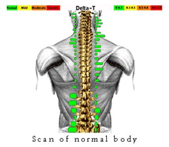 Infrared Thermography Scan