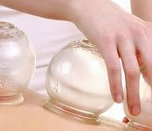 Cupping therapy by Dr. Florida is an excellent form of natural pain relief for sciatica back pain.
