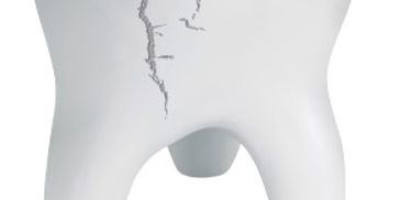 #Fairviewdental #dentist #Dentaloffice #DentistSantaAna #DentalofficeSantaAna #emergency dentistry