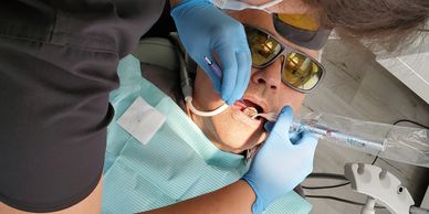 dental cleaning and extraction