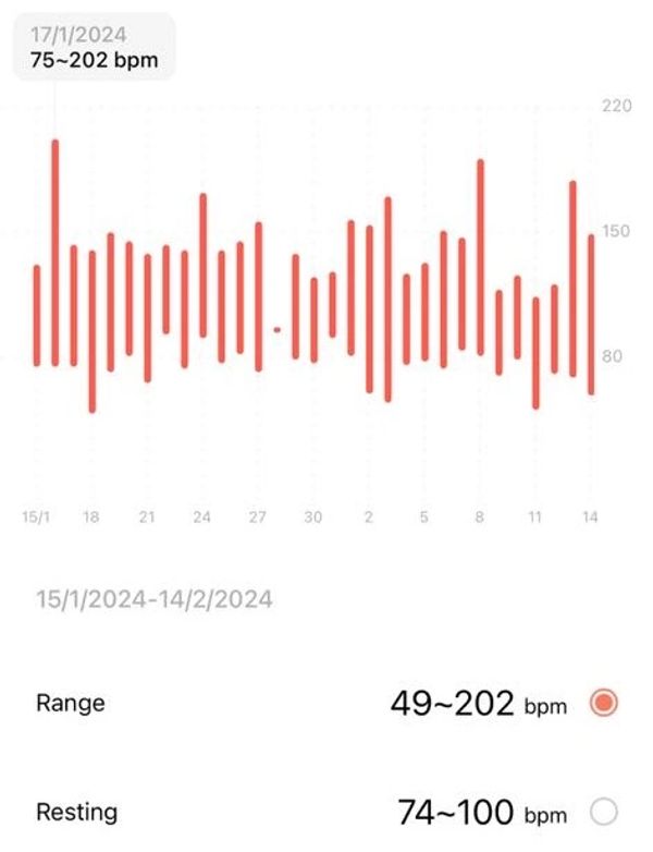With Postural Orthostatic Tachycardia Syndrome (POTS), my heart rate increases abnormally.