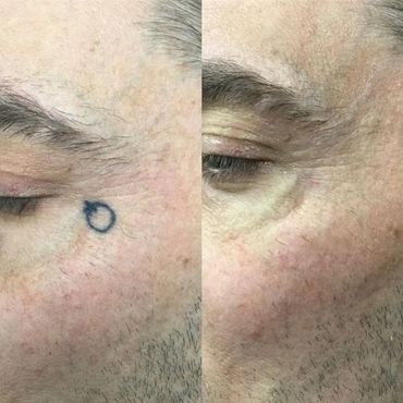 Small but powerful image gone