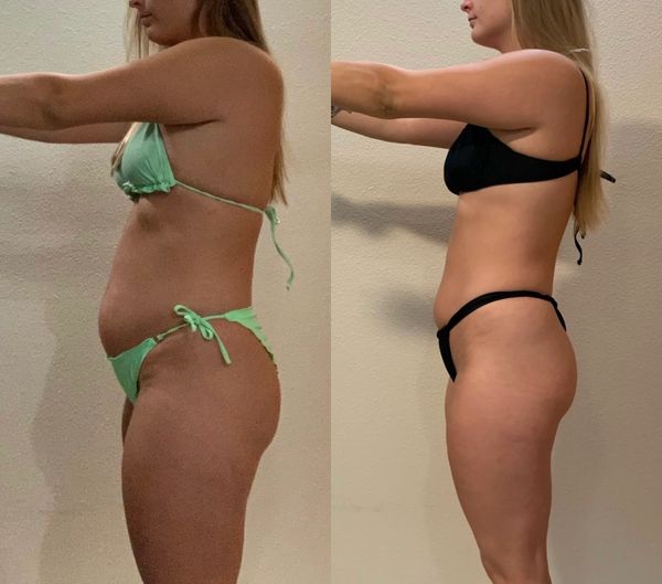 A lifestyle weight loss transformation down twenty pounds
