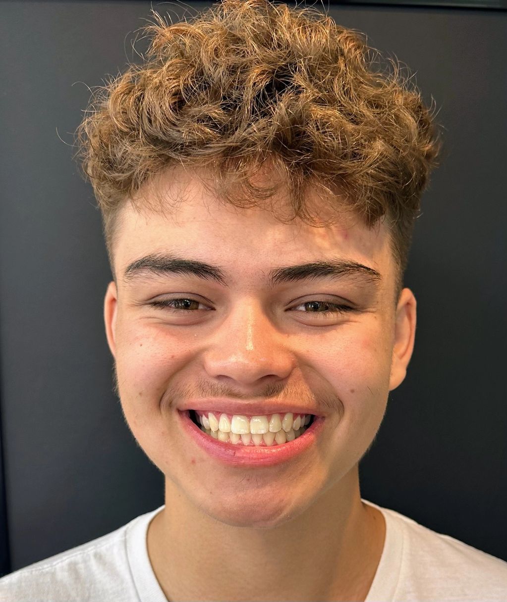 After Clear Aligner Treatment with Dr. Droskin