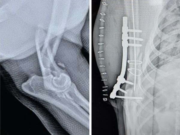 Before and after photos of knee surgery