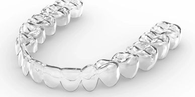 Clear dental aligners on a white surface.