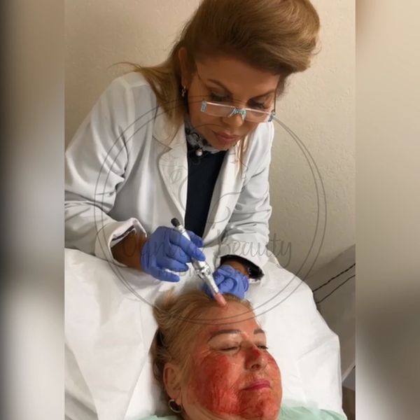 Olinda Silva, esteticista, realizando tratamiento microneedling a mujer.