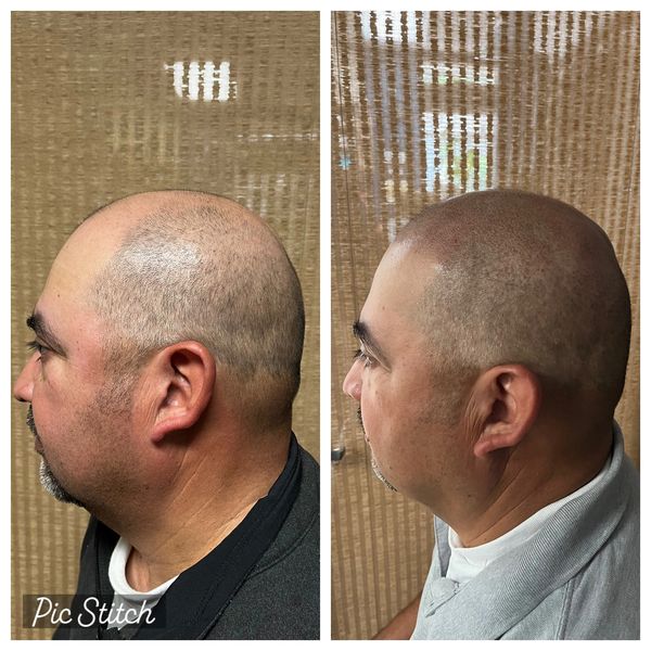 Look younger in just a few appointments!