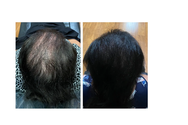 High Density SMP- Female Un-retouched Photo