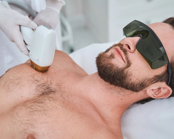 Man with Hairy Chest Receiving Laser Hair Removal