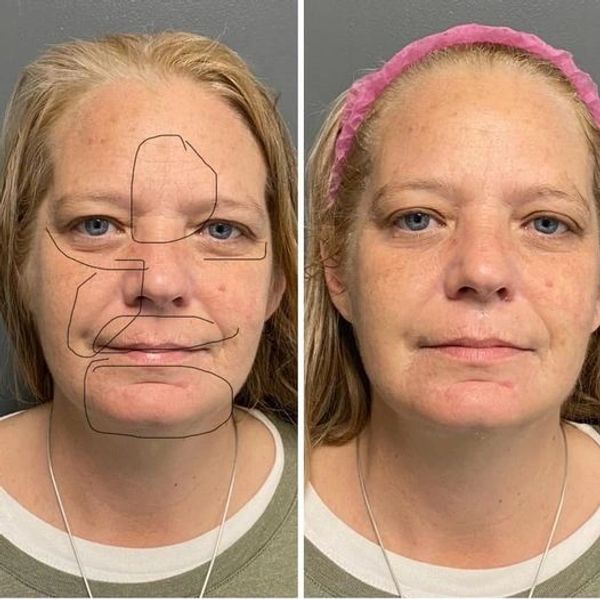 Picture of woman's face, before and after.
