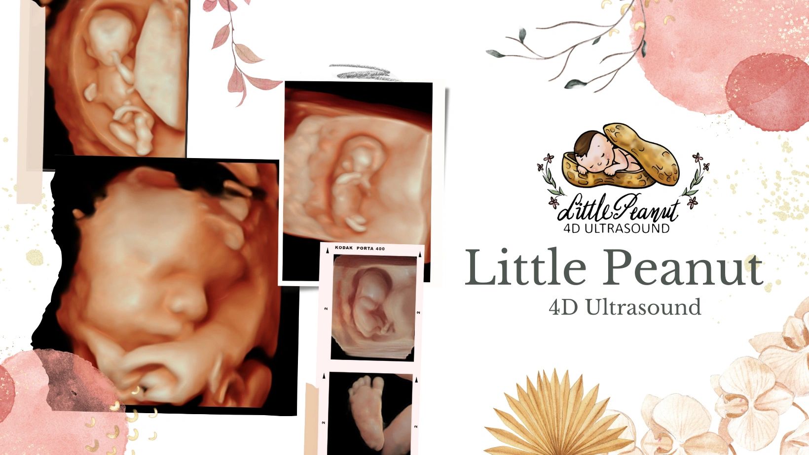 3Д little sex Little Peanut 4D Ultrasound - 3D 4D Ultrasound, Gender Ultrasound