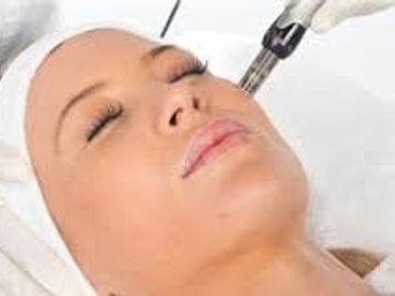 Microneedling is most likely the best treatment for skin resurfacing and the way it works is by using needles that are long enough to cause microscopic injuries to the fine blood vessels that are at the level of the hair follicles.