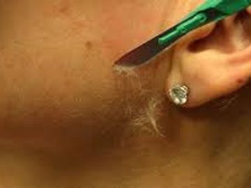 Dermaplaning  Removes the peach fuzz leaving your skin smooth and ready to put your make up on giving you that perfect look.