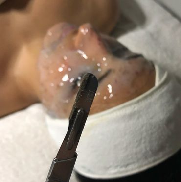 Derma blade and facial spa procedure removing dead skin for high penetration to reveal glowy skin