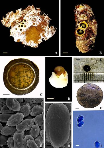 Sphaerobolus jaysukhianus sp. nov.