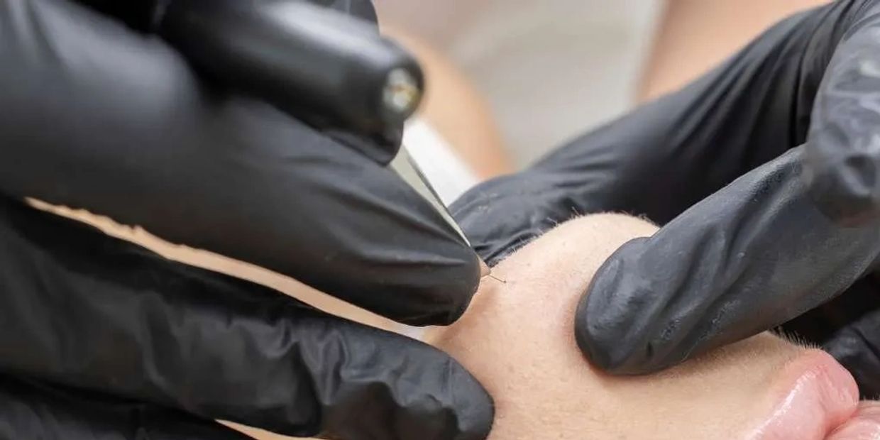 Close-up of a tattoo artist working with a needle on skin wearing black gloves.