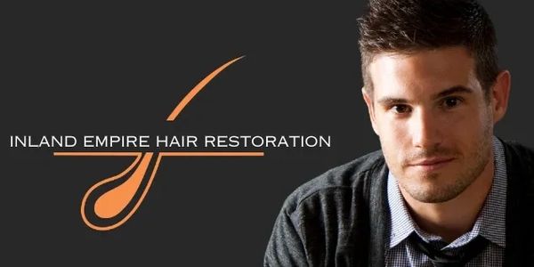 Man with full head of hair next to our Inland Empire Hair Restoration logo,
