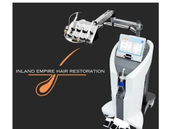 Image of the Neograft hair transplantation machine and the Inland Empire Hair Restoration logo.