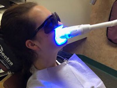 teeth whitening