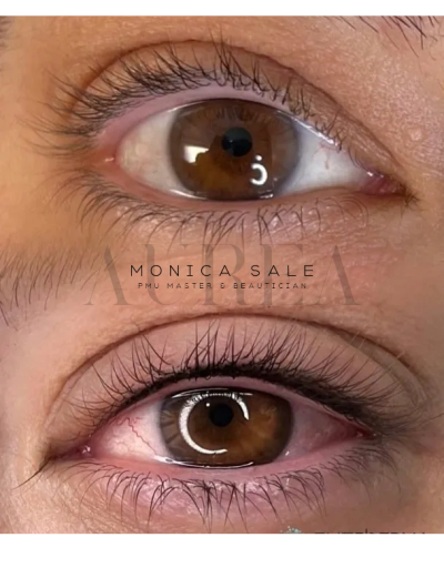 Infracigliare: prima e dopo
Monica Sale