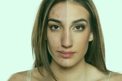 Psoriasis treatment in vasai west Ayurvedic medicmes and therapies for skin problems in vasai