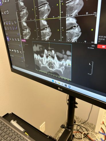 Computer screen displaying dental X-ray images and scans.