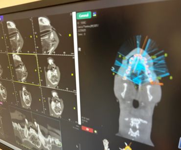 Dental CT scan images showing detailed jaw and teeth structure.