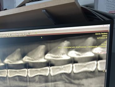 X-ray image of a section of a skull with visible bone structures.