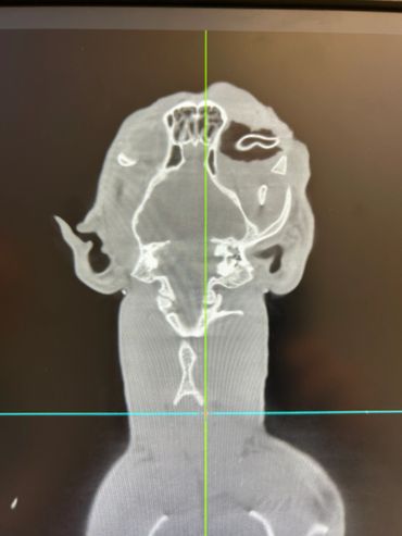 CT scan showing detailed cross-section of head and neck bones.