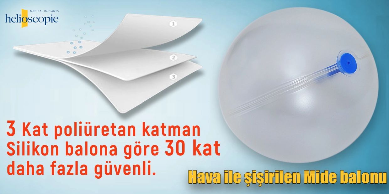 mide balonu